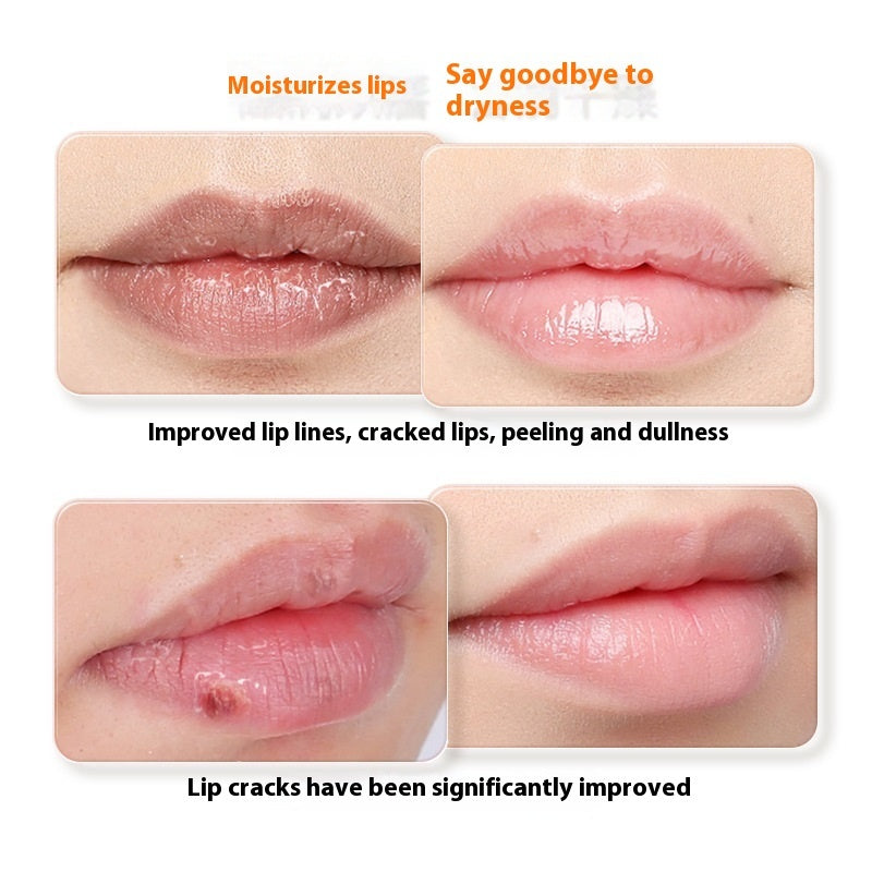 Lip Guard Nourishing Moisturizing Hydrating And Anti-chapping Colorless