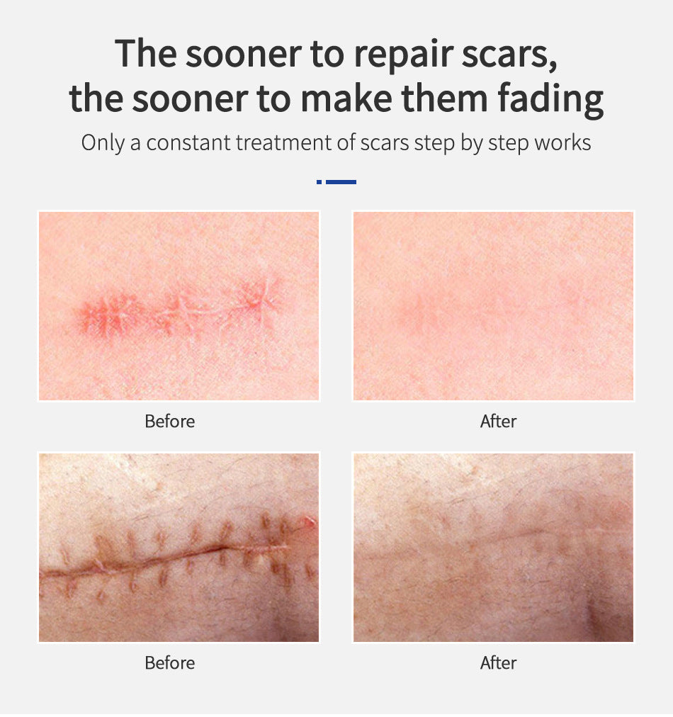 Shark Scar Repairing Toner Bar Mark Liquid Essential Liquid