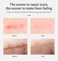Shark Scar Repairing Toner Bar Mark Liquid Essential Liquid